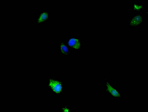 MAP2K5 / MEK5 Antibody - Immunofluorescent analysis of Hela cells using MAP2K5 Antibody at a dilution of 1:100 and Alexa Fluor 488-congugated AffiniPure Goat Anti-Rabbit IgG(H+L)