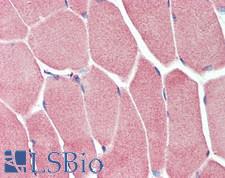 MAP2K5 / MEK5 Antibody - Human Skeletal Muscle: Formalin-Fixed, Paraffin-Embedded (FFPE), at a concentration of 10 ug/ml.
