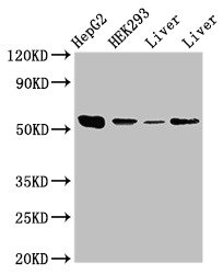 MAP2K5 / MEK5 Antibody - Western Blot Positive WB detected in: HepG2 whole cell lysate, HEK293 whole cell lysate, Rat liver tissue, Mouse liver tissue All lanes: MAP2K5 antibody at 3.5µg/ml Secondary Goat polyclonal to rabbit IgG at 1/50000 dilution Predicted band size: 51, 49, 50, 47 kDa Observed band size: 51 kDa