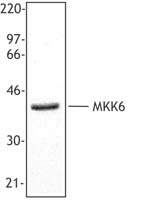 MAP2K6 / MEK6 / MKK6 Antibody - Jurkat cell extract was resolved by electrophoresis, transferred to nitrocellulose, and probed with rabbit anti-MKK6 antibody. Proteins were visualized using a donkey anti-rabbit secondary conjugated to HRP and a chemiluminescence detection system.
