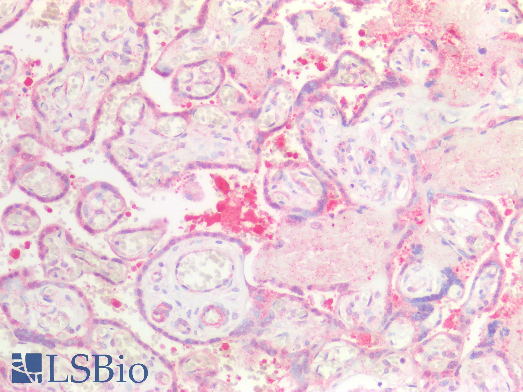 MAP2K7 / MEK7 Antibody - Human Placenta: Formalin-Fixed, Paraffin-Embedded (FFPE)