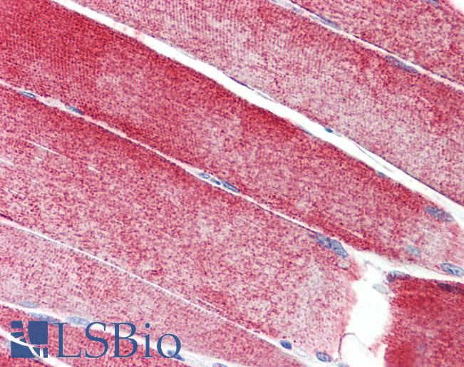MAP3K10 / MLK2 Antibody - Anti-MAP3K10 / MLK2 antibody IHC staining of human skeletal muscle. Immunohistochemistry of formalin-fixed, paraffin-embedded tissue after heat-induced antigen retrieval.