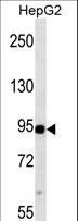 MAP3K11 / MLK3 Antibody - MAP3K11 western blot of HepG2 cell line lysates (35 ug/lane). The MAP3K11 antibody detected the MAP3K11 protein (arrow).