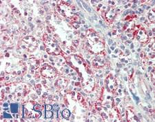 MAP3K11 / MLK3 Antibody - Human Spleen: Formalin-Fixed, Paraffin-Embedded (FFPE)