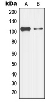 MAP3K13 / LZK Antibody - Western blot analysis of LZK expression in K562 (A); HepG2 (B) whole cell lysates.
