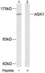MAP3K5 / ASK1 Antibody - Western blot analysis of lysates from MDA-MB-435 cells, using ASK1 Antibody. The lane on the right is blocked with the synthesized peptide.