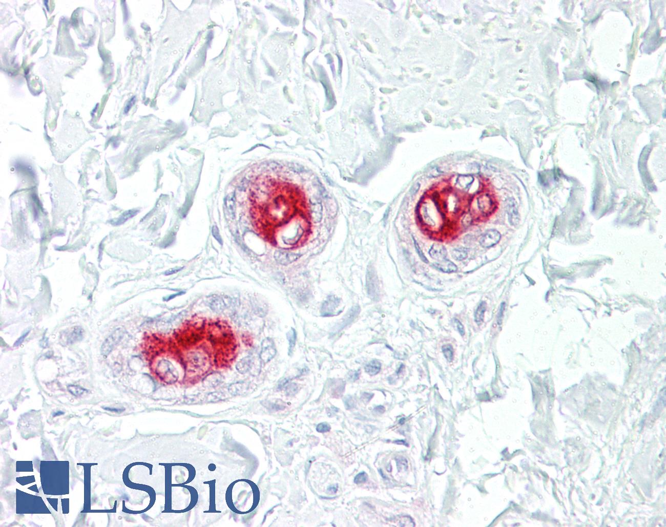 MAP3K5 / ASK1 Antibody - Anti-MAP3K5 / ASK1 antibody IHC of human skin, sweat ducts. Immunohistochemistry of formalin-fixed, paraffin-embedded tissue after heat-induced antigen retrieval. Antibody dilution 1:100.