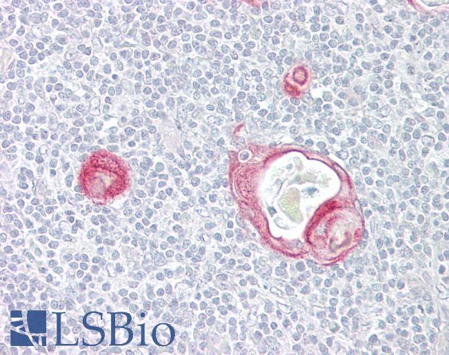 MAP3K5 / ASK1 Antibody - Anti-MAP3K5 / ASK1 antibody IHC of human thymus. Immunohistochemistry of formalin-fixed, paraffin-embedded tissue after heat-induced antigen retrieval. Antibody dilution 1:100.