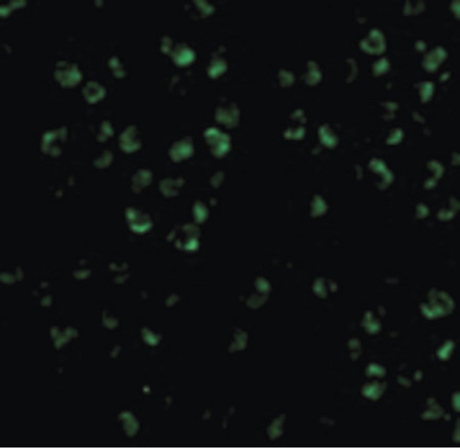 MAP3K5 / ASK1 Antibody - Immunofluorescence of ASK1 in 3T3 cells with ASK1 antibody at 20 ug/ml.