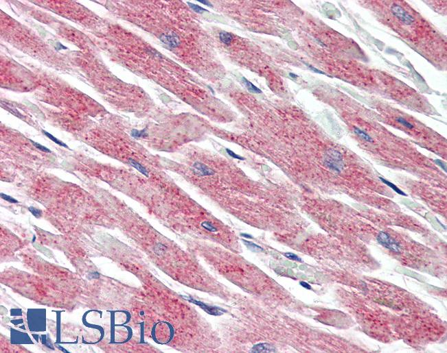 MAP3K5 / ASK1 Antibody - Anti-MAP3K5 / ASK1 antibody IHC of human heart. Immunohistochemistry of formalin-fixed, paraffin-embedded tissue after heat-induced antigen retrieval. Antibody concentration 5 ug/ml.