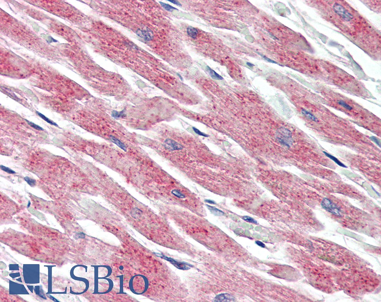 MAP3K5 / ASK1 Antibody - Anti-MAP3K5 / ASK1 antibody IHC of human heart. Immunohistochemistry of formalin-fixed, paraffin-embedded tissue after heat-induced antigen retrieval. Antibody concentration 5 ug/ml.