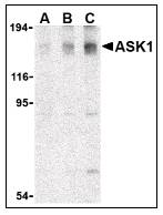 MAP3K5 / ASK1 Antibody - Western blot of ASK1 in SW1353 cell lysate with MAP3K5 / ASK1 Antibody at (A) 0.5, (B) 1, and (C) 2 ug/ml.