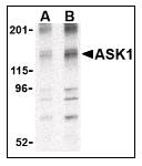 MAP3K5 / ASK1 Antibody - Western blot of ASK1 in 3T3 cell lysate with  MAP3K5 / ASK1 Antibody at (A) 1 and (B) 2 ug/ml.