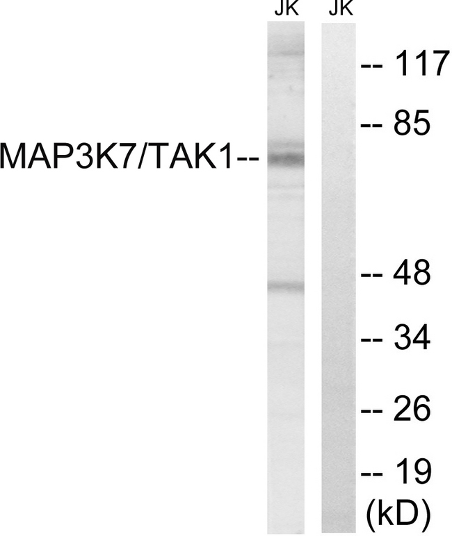 MAP3K7 / TAK1 Antibody - Western blot analysis of lysates from Jurkat cells, treated with heat shock, using MAP3K7 Antibody. The lane on the right is blocked with the synthesized peptide.