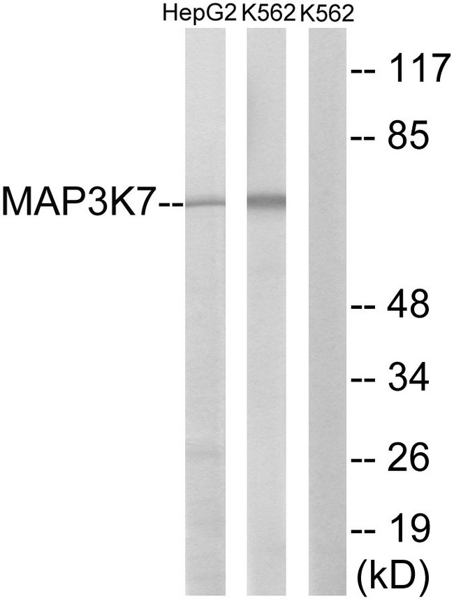 MAP3K7 / TAK1 Antibody - Western blot analysis of lysates from K562 cells and HepG2 cells, using MAP3K7 Antibody. The lane on the right is blocked with the synthesized peptide.