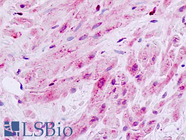 MAP3K9 / MLK1 Antibody - Human, Prostate, smooth muscle: Formalin-Fixed Paraffin-Embedded (FFPE)