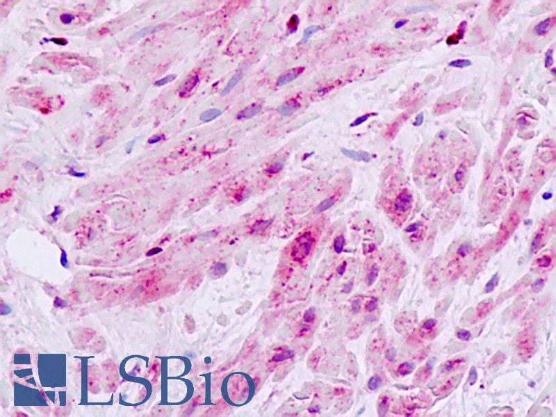 MAP3K9 / MLK1 Antibody - Human, Prostate, smooth muscle: Formalin-Fixed Paraffin-Embedded (FFPE)