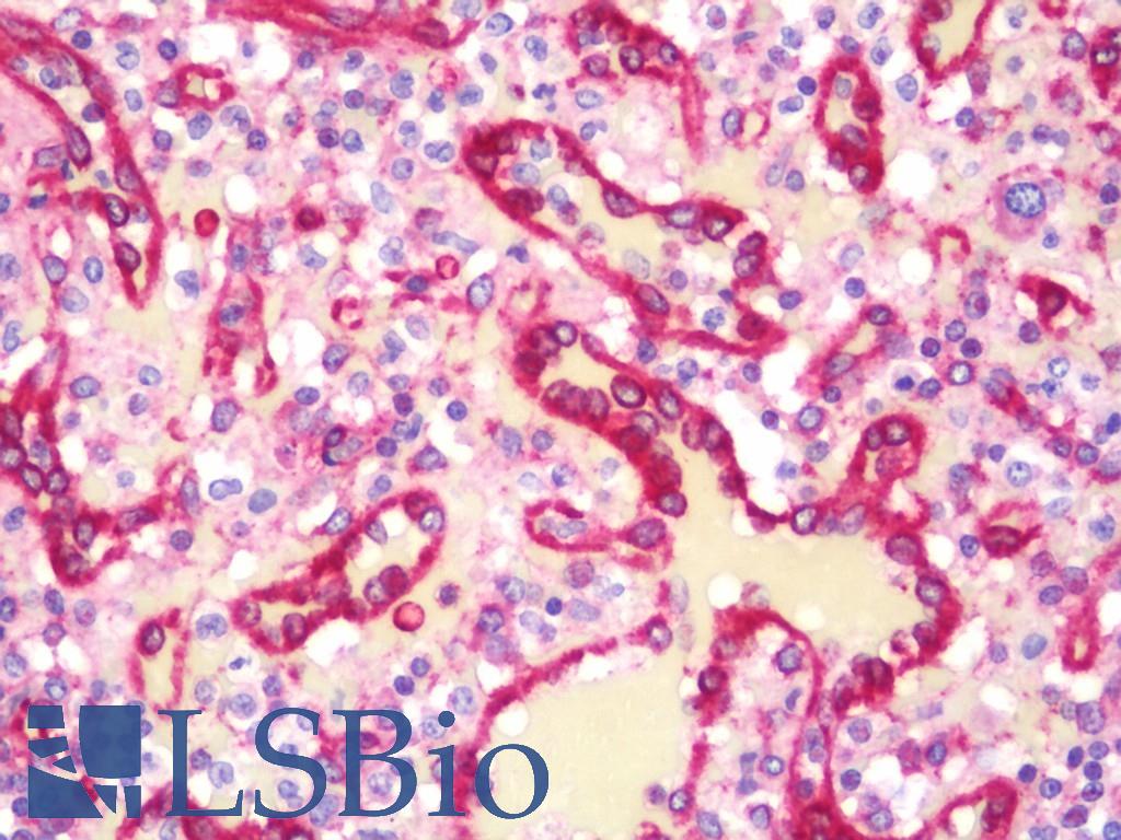 MAP4 Antibody - Anti-MAP4 antibody IHC staining of human spleen. Immunohistochemistry of formalin-fixed, paraffin-embedded tissue after heat-induced antigen retrieval. Antibody dilution 1:100.