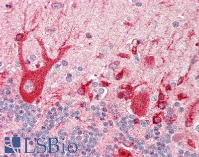 MAP4 Antibody - Human Brain, Cerebellum: Formalin-Fixed, Paraffin-Embedded (FFPE)