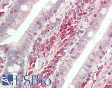MAPK1 / ERK2 Antibody - Human Small Intestine: Formalin-Fixed, Paraffin-Embedded (FFPE)