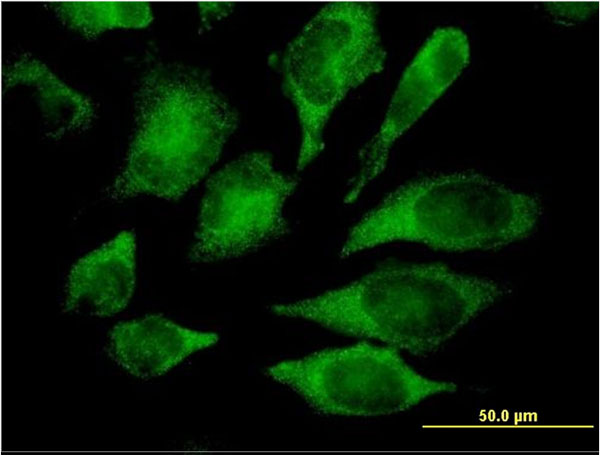 MAPK13 / p38delta Antibody - Immunofluorescence of monoclonal antibody to MAPK13 on HeLa cell. [antibody concentration 10 ug/ml]
