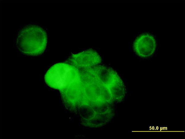 MAPK13 / p38delta Antibody - Immunofluorescence of monoclonal antibody to MAPK13 on MCF-7 cell. [antibody concentration 10 ug/ml].