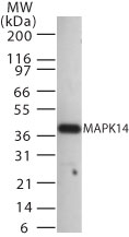 MAPK14 / p38 Antibody - Western blot of MAPK14 in 20 ugs of human pancreas cell lysate using antibody at 1:1000.