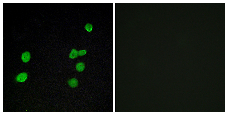 MAPK6 / ERK3 Antibody - Immunofluorescence analysis of MCF7 cells, using p97 MAPK Antibody. The picture on the right is blocked with the synthesized peptide.