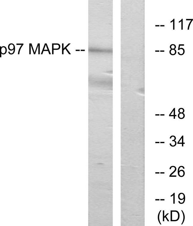 MAPK6 / ERK3 Antibody - Western blot analysis of lysates from K562 cells, using p97 MAPK Antibody. The lane on the right is blocked with the synthesized peptide.
