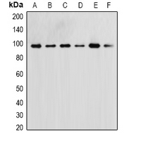 MAPK7 / ERK5 Antibody - Western blot analysis of ERK5 expression in HeLa (A); 293T (B); NIH3T3 (C); mouse skeletal muscle (D); rat kidney (E); rat skeletal muscle (F) whole cell lysates.