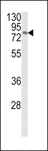 MAPK8IP1 / JIP1 Antibody - Western blot of JIP1 Antibody in MCF-7 cell line lysates (35 ug/lane). JIP1 (arrow) was detected using the purified antibody.