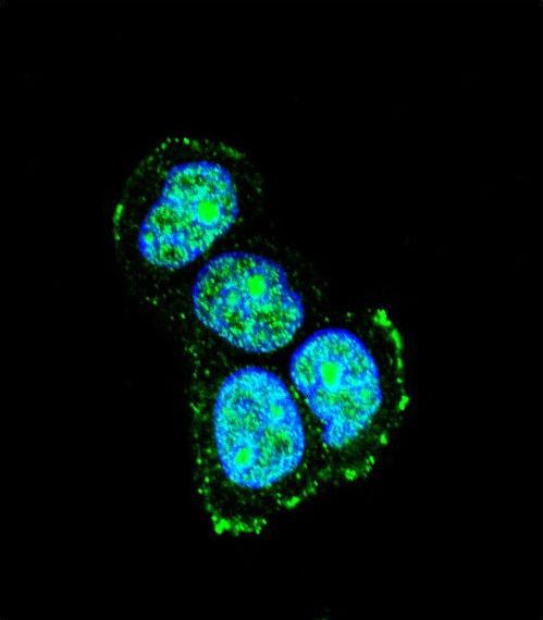 MAPK8IP1 / JIP1 Antibody - Confocal immunofluorescence of JIP1 Antibody with MCF-7 cell followed by Alexa Fluor 488-conjugated goat anti-rabbit lgG (green). DAPI was used to stain the cell nuclear (blue).