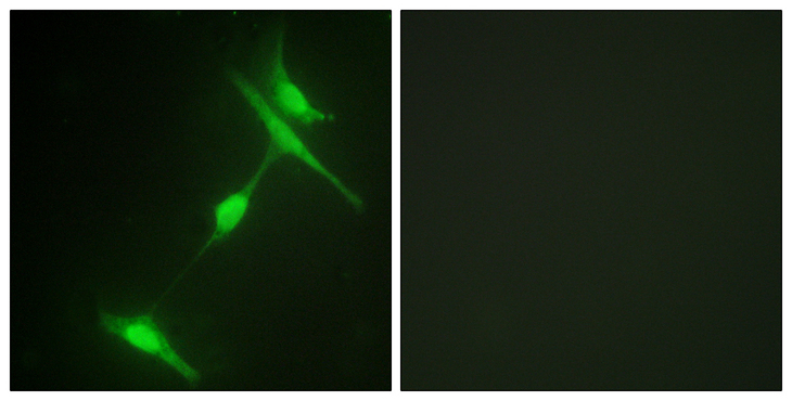 MAPK8IP1 / JIP1 Antibody - Immunofluorescence analysis of NIH/3T3 cells, using JIP1 Antibody. The picture on the right is blocked with the synthesized peptide.