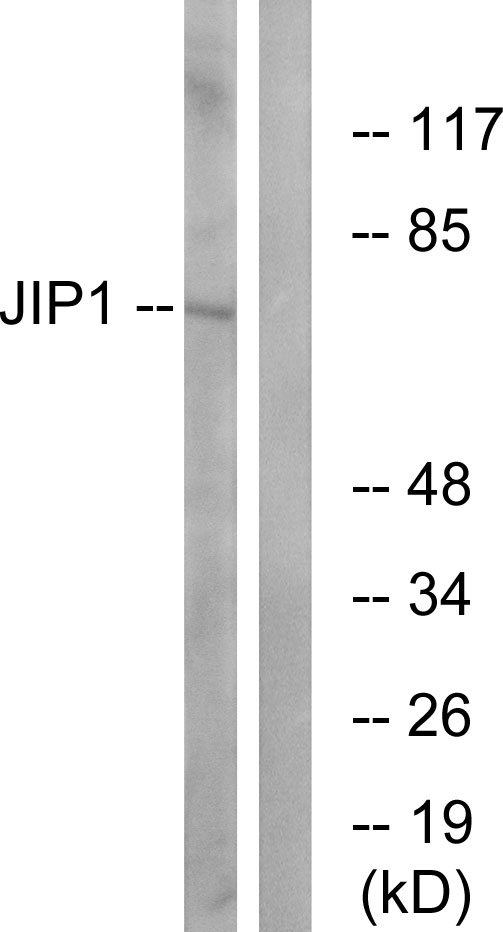 MAPK8IP1 / JIP1 Antibody - Western blot analysis of lysates from COLO205 cells, treated with Serum 20% 15', using JIP1 Antibody. The lane on the right is blocked with the synthesized peptide.