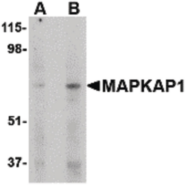 MAPKAP1 / MIP1 Antibody - Western blot of MAPKAP1 in human skeletal muscle tissue lysate with MAPKAP1 antibody at (A) 1 and (B) 2 ug/ml.