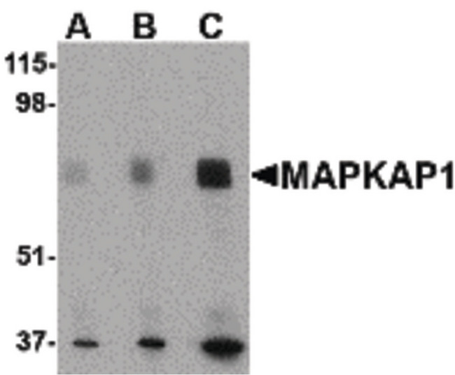 MAPKAP1 / MIP1 Antibody - Western blot of MAPKAP1 in human skeletal muscle tissue lysate with MAPKAP1 antibody at (A) 0.5, (B) 1 and (C) 2 ug/ml.