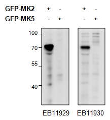 MAPKAPK2 / MAPKAP Kinase 2 Antibody - MAPKAPK2 antibody HEK293 overexpressing Mouse MK2 fused to GFP or overexpressing MK5 fused to GFP and probed with (0.5 ug/ml) in the left panel and with EB11930 (0.5 ug/ml) in the right panel.