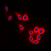 MAPT / Tau Antibody - Immunofluorescent analysis of TAU staining in SKNSH cells. Formalin-fixed cells were permeabilized with 0.1% Triton X-100 in TBS for 5-10 minutes and blocked with 3% BSA-PBS for 30 minutes at room temperature. Cells were probed with the primary antibody in 3% BSA-PBS and incubated overnight at 4 C in a humidified chamber. Cells were washed with PBST and incubated with a DyLight 594-conjugated secondary antibody (red) in PBS at room temperature in the dark. DAPI was used to stain the cell nuclei (blue).