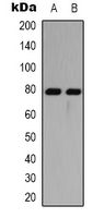 MAPT / Tau Antibody - Western blot analysis of TAU expression in Jurkat (A); PC12 (B) whole cell lysates.