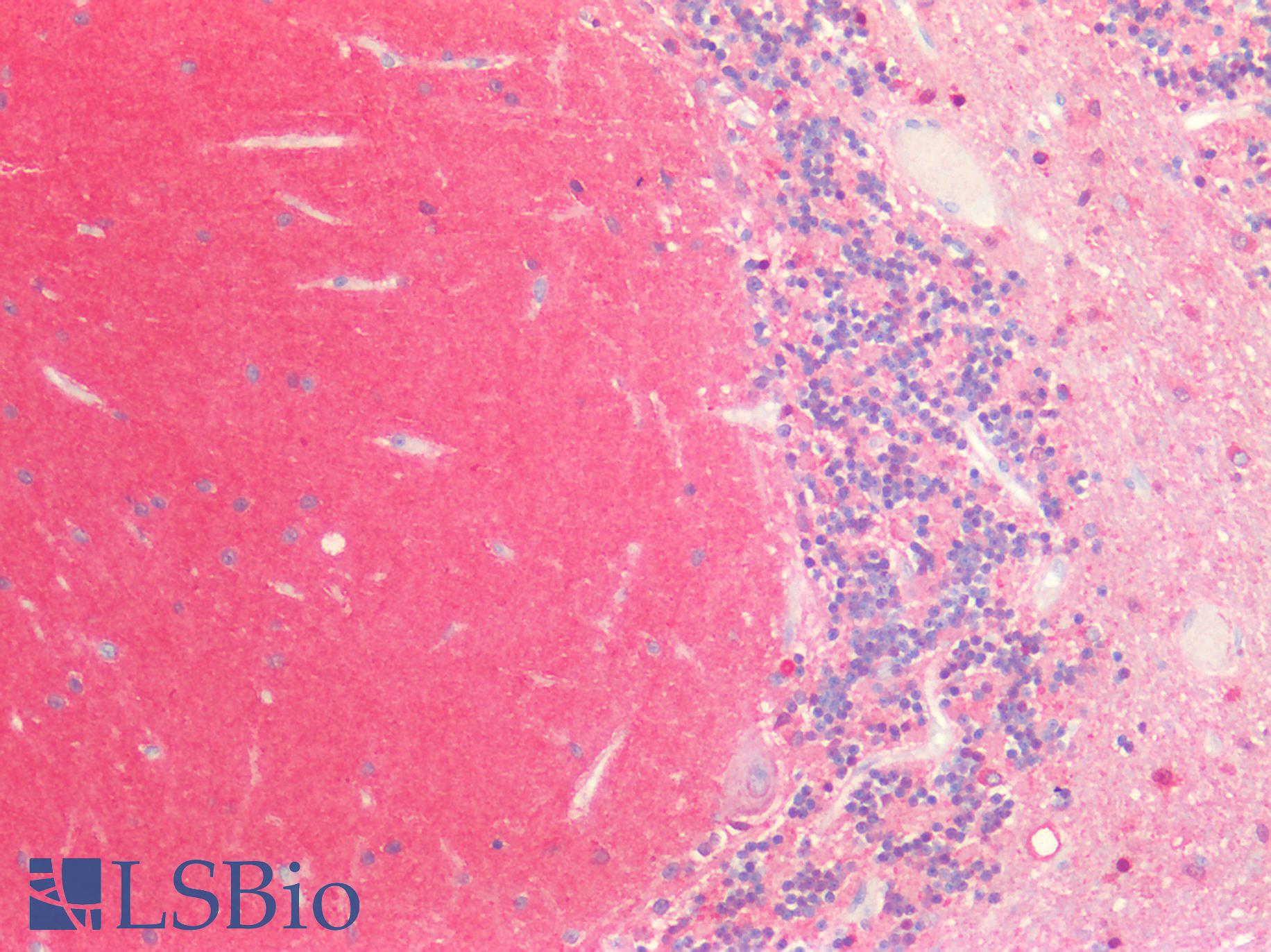 MAPT / Tau Antibody - Human Brain, Cerebellum: Formalin-Fixed, Paraffin-Embedded (FFPE)