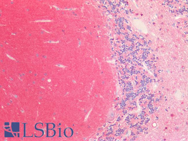 MAPT / Tau Antibody - Human Brain, Cerebellum: Formalin-Fixed, Paraffin-Embedded (FFPE)