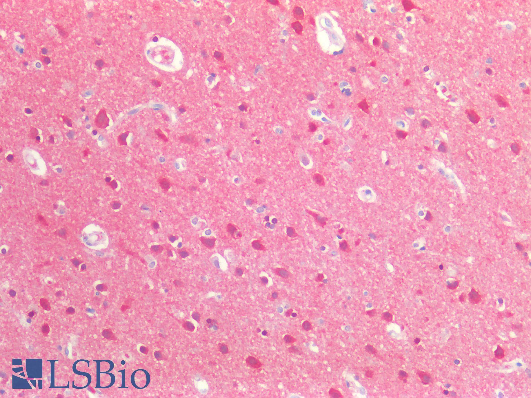 MAPT / Tau Antibody - Human Brain, Cortex: Formalin-Fixed, Paraffin-Embedded (FFPE)