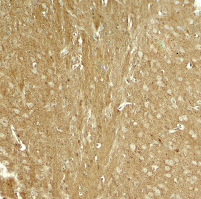 MAPT / Tau Antibody - Immunohistochemistry of TAU in mouse brain tissue with TAU antibody at 5 ug/ml.