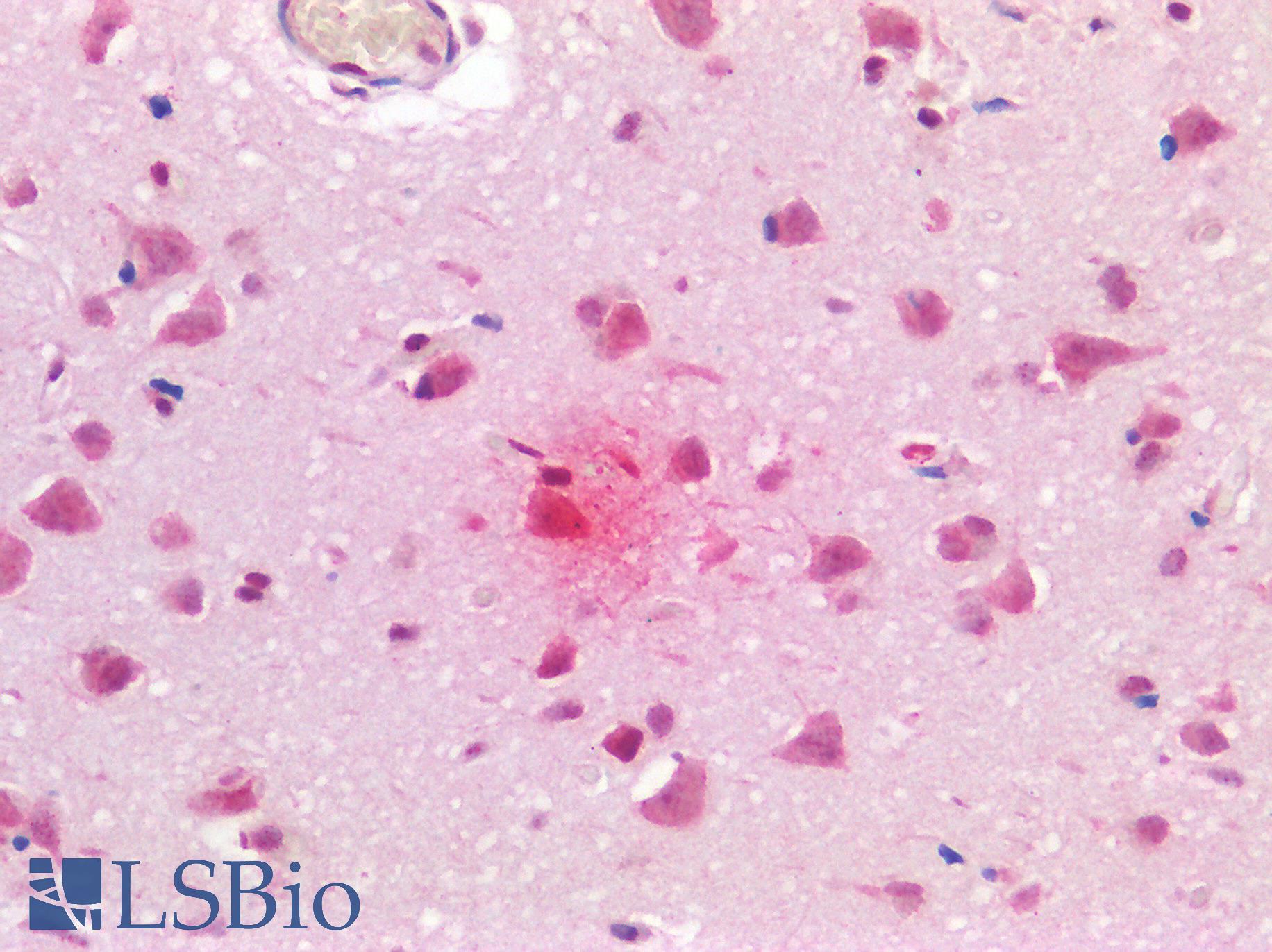 MAPT / Tau Antibody - Human Brain, Cortex, Alzheimer's Senile Plaque: Formalin-Fixed, Paraffin-Embedded (FFPE)
