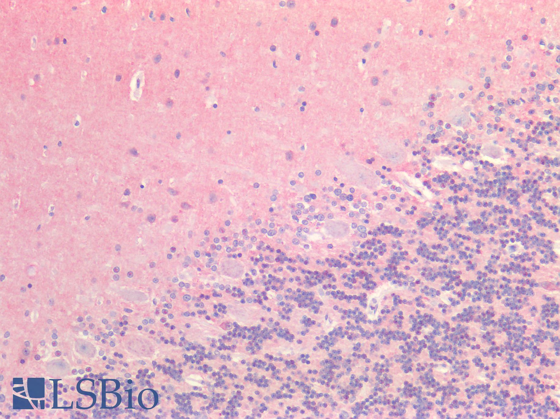 MAPT / Tau Antibody - Human Brain, Cerebellum: Formalin-Fixed, Paraffin-Embedded (FFPE)