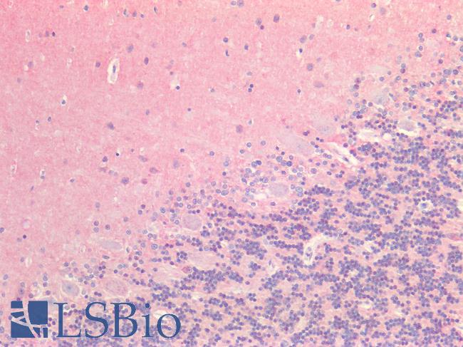 MAPT / Tau Antibody - Human Brain, Cerebellum: Formalin-Fixed, Paraffin-Embedded (FFPE)