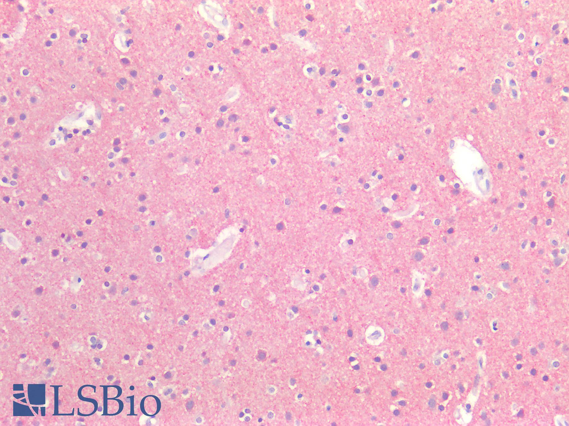 MAPT / Tau Antibody - Human Brain, Cortex: Formalin-Fixed, Paraffin-Embedded (FFPE)