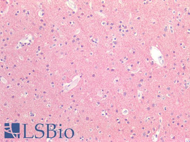 MAPT / Tau Antibody - Human Brain, Cortex: Formalin-Fixed, Paraffin-Embedded (FFPE)