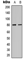 MAPT / Tau Antibody - Western blot analysis of TAU (pS404) expression in SHSY5Y (A); mouse brain (B) whole cell lysates.