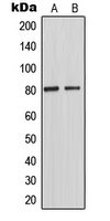 MAPT / Tau Antibody - Western blot analysis of TAU (pT231) expression in mouse brain (A) whole cell lysates.